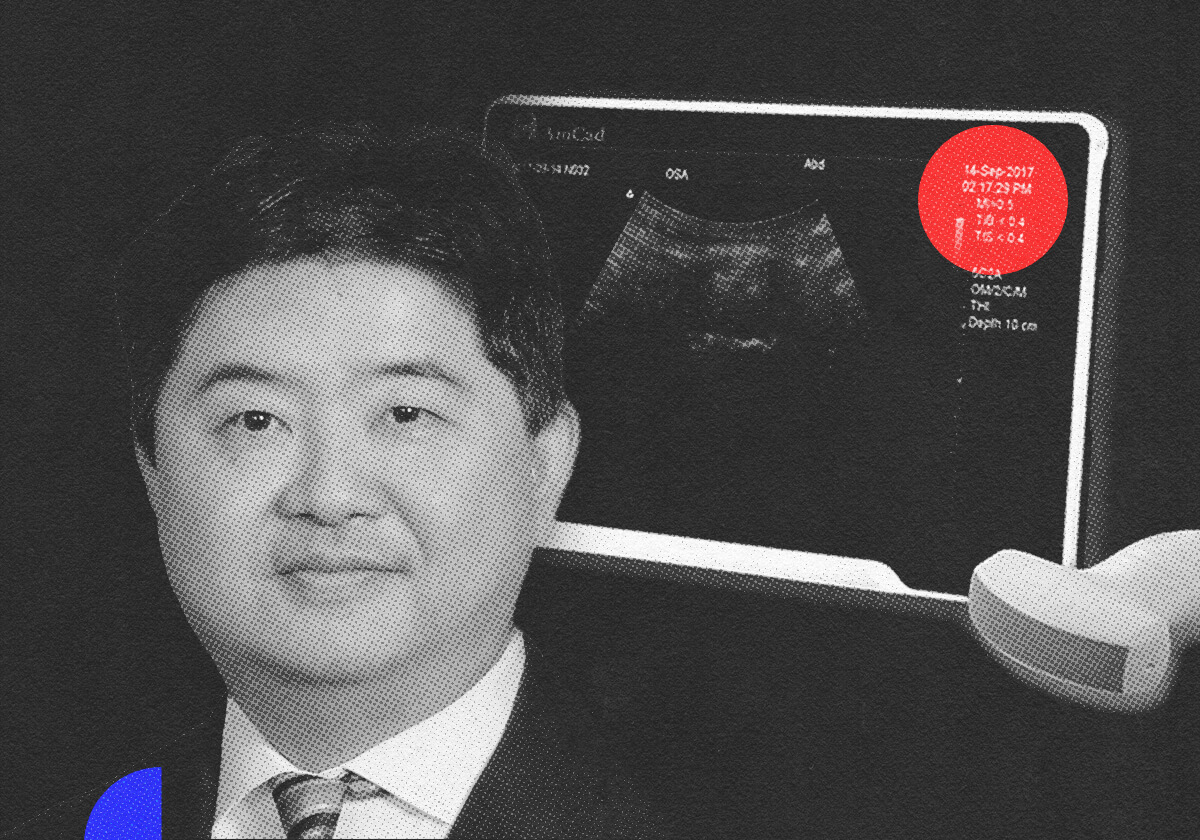 Early Sleep Apnea detection with AI